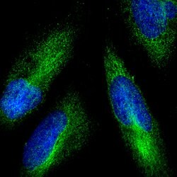 Goat anti-Rabbit IgG (H+L) Highly Cross-Adsorbed Secondary Antibody, Alexa